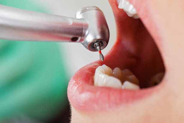 Best Pediatric Emergency Dentist in Sharon Center, OH